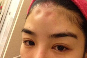 黄奕律师:验伤记录足证家暴 夫妻共同财产不多