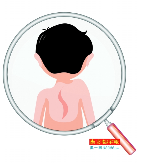 孩子弯腰驼背当心是脊柱侧弯_健康快讯_深健